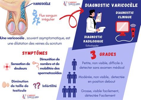 Varicocele Grade 1