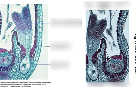 lab 9: Longitudinal section of Capsella embryo with cotyledons Diagram ...