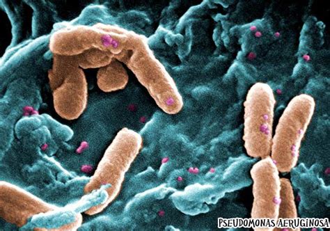 Bacterial Diseases | Top 14 Most Deadliest Diseases Caused By Bacteria