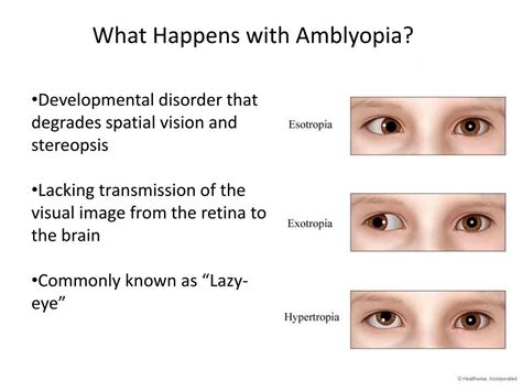 PPT - What is Stereopsis ? PowerPoint Presentation, free download - ID:1870679