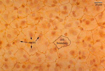 Epithelium Histology - Mesothelium (labels) - histology slide