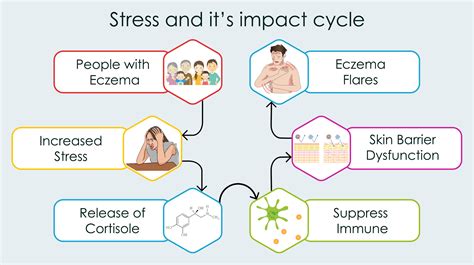 Eczema & Stress | Stress Eczema Treatment | Eczema Due To Stress | Eczema Less