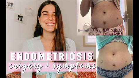 ENDOMETRIOSIS | my surgery + diagnosis experience - YouTube