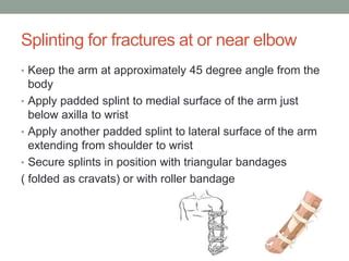 Splinting in first aid | PPT