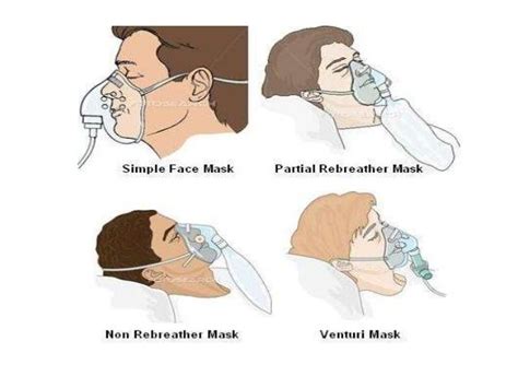 Techniques of oxygen delivery | Nursing notes, Nursing school survival ...