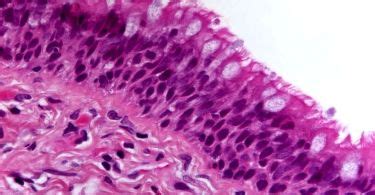 Epithelial Cells Archives - Pediaa.Com