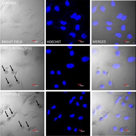 Hoechst staining. Nuclear morphological changes were observed through... | Download Scientific ...