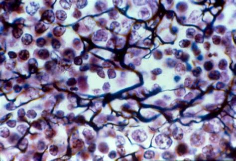 Loose Connective Tissue Reticular