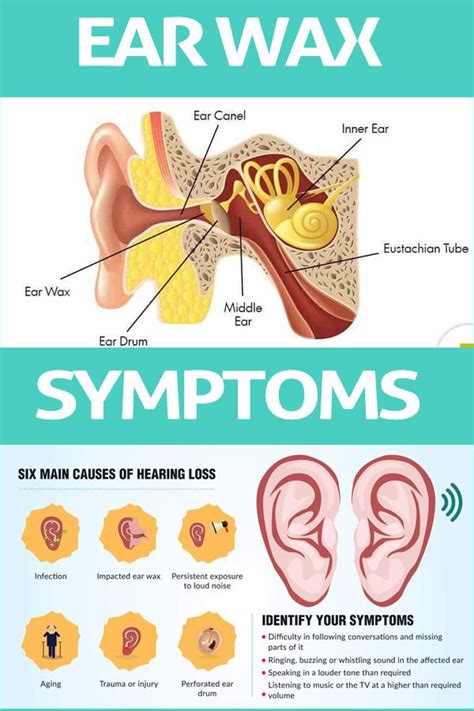 How To Remove Ear Wax Blockage Fast Video - HOWOTREMVO