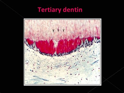 Histology of dentin