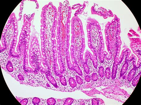 As bactérias do intestino podem influenciar nossos genes - Revista ...