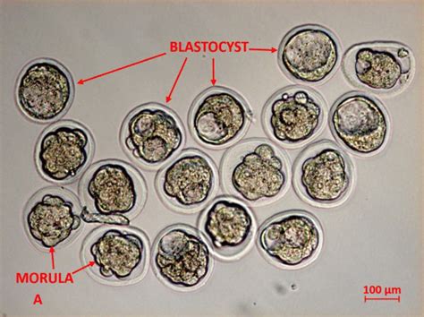 Embryo observed at magnification of 200×, (A) morula-and... | Download ...