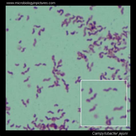 Campylobacter. Gram stain and cell morphology. Campylobacter micrograph, appearance under ...