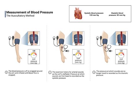 Measurement of Blood Pressure: The Auscultatory Method | BioRender ...