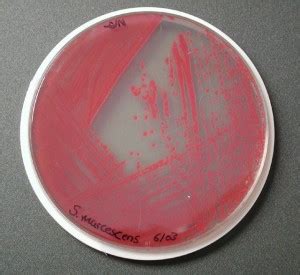 Serratia