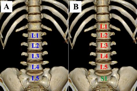 Best Nature Transitional Vertebrae Types Terre Haute IN