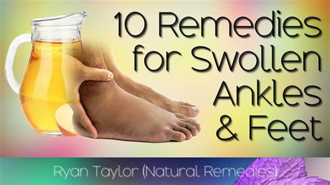 10 Home Remedies for: Swollen Feet and Ankles - YouTube