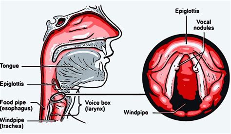 Understanding Throat Nodes: Causes, Symptoms, and Treatment – Hidden-Team