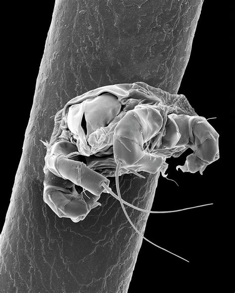 Mite On Human Hair Photograph by Dennis Kunkel Microscopy/science Photo Library - Fine Art America