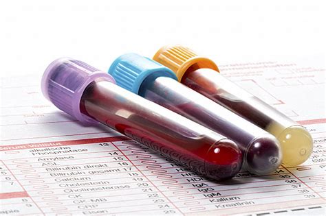 Interpreting Blood Test Results: A Comprehensive Guide - One Click Pharm