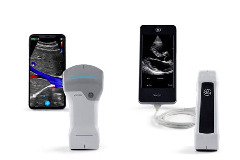 Emergency Ultrasound Machine - GE HealthCare India