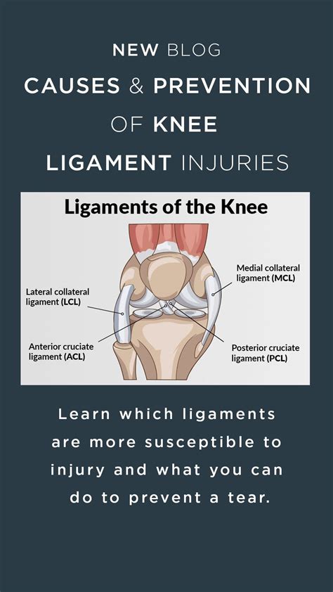 Learn which ligaments are more susceptible to injury and what you can do to prevent a tear. Knee ...