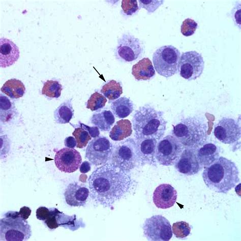 Figure 3: Bronchoalveolar lavage from a horse with skin lesions and ...