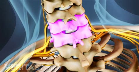 All About the C5-C6 Spinal Segment