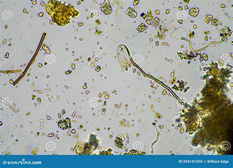 Microorganisms And Soil Biology, With Nematodes And Fungi Under The Microscope. In A Soil And ...