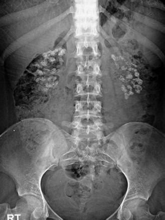 Radiology Quiz 7499 | Radiopaedia.org