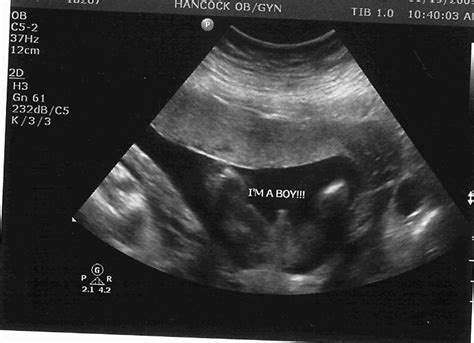 The Starr Family Blog: Baby Boy Ultrasound