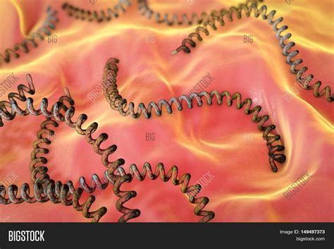 Leptospira, Spiral Image & Photo (Free Trial) | Bigstock