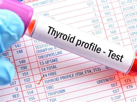 Underactive Thyroid: 10 Underactive Thyroid Symptoms