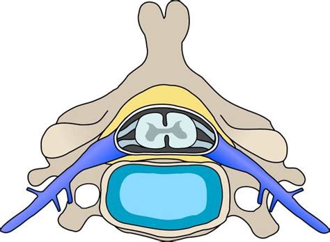 Possible causes for bilateral ankle clonus if spine and brain MRI are normal? Clonus is more ...