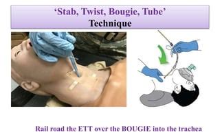 Surgical airway techniques | PPT