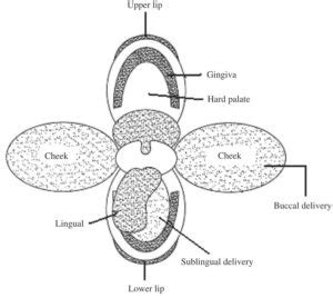 Buccal Drug Delivery System - Solution Parmacy