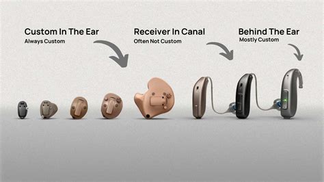 Everything You Need to Know About Hearing Aid Earmolds Vs. Open-Fit Domes