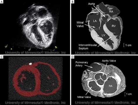 Ultrasound of the heart - what is it, how is the diagnostic | Health ...