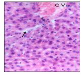 Acute Toxicity by Hair Dye in Upper Egypt