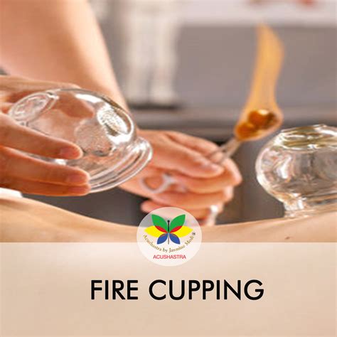 Fire Cupping - Jasmine Modi