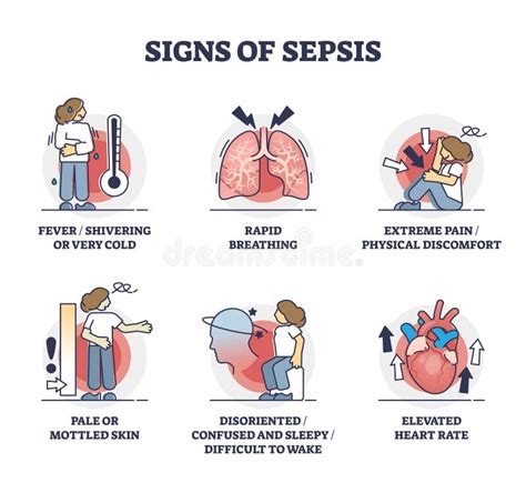 Tekenen Van Sepsis Als Infectie Bloedvergiftigingsverschijnselen Schetsen Inzameling Vector ...