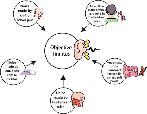 Tinnitus Sexual Dysfunction Top Sellers | centralcountiesservices.org