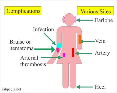 Blood Sample: – Part 1 – Complications during blood collection and Treatment – Labpedia.net