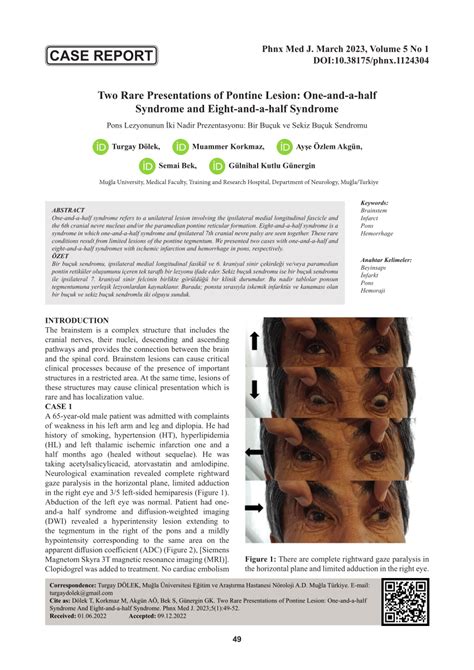 (PDF) Two Rare Presentations of Pontine Lesions: One-And-A-Half Syndrome and Eight-And-A-Half ...