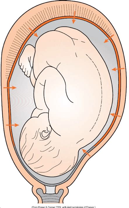 In Defence of the Amniotic Sac | MidwifeThinking