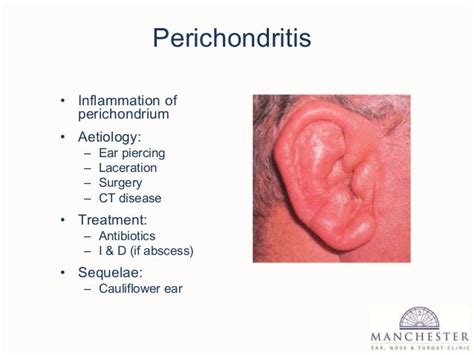 External and middle ear disease for g ps