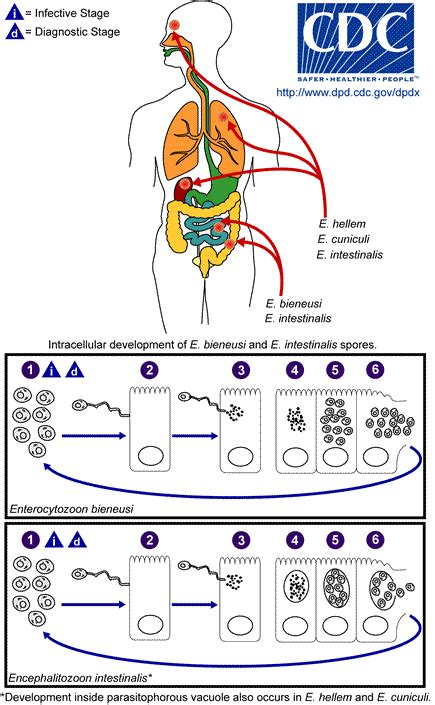 Microsporidiosis - TheBody.com