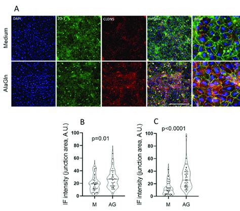 Visualization and quantification of tight junction protein ...