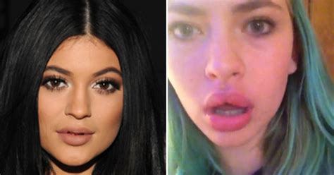 Experts: 'Kylie Jenner Lip Challenge' Is Dangerous And Damaging - CBS New York