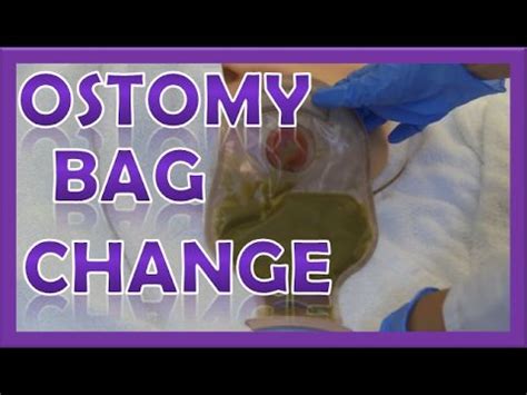 Ostomy Bag Pouch Change | Ostomy Care Nursing | Colostomy, Ileostomy ...